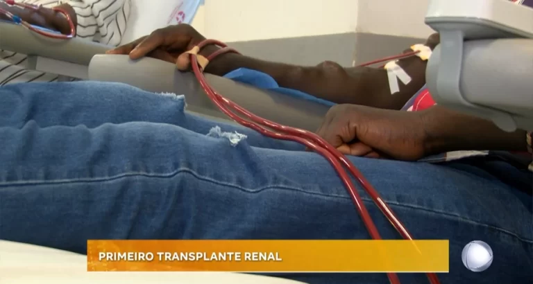 PRIMEIRO TRANSPLANTE RENAL