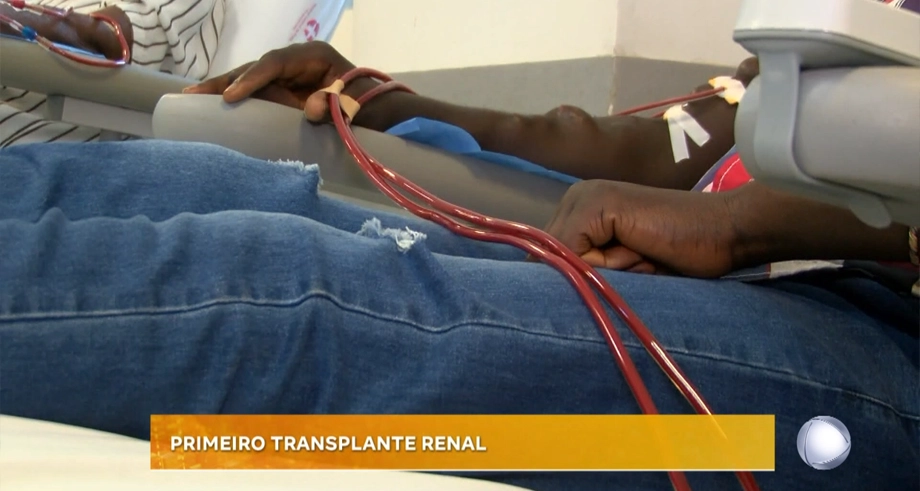 PRIMEIRO TRANSPLANTE RENAL